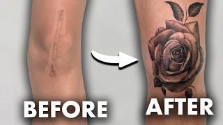 Cover Your Scars and Stretch marks With A Tattoo [upl. by Georgiana]