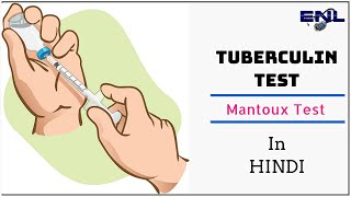 Mantoux Test  Tuberculin Skin Test in Hindi  Easy Explanation [upl. by Neely816]