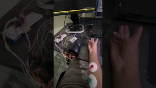 EMGBased Robotic Arm Control [upl. by Adnahsor]