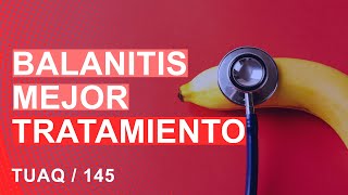 BALANITIS Mejor tratamiento [upl. by Aholla]