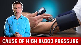 Real Cause Of High Blood Pressure Hypertension – Dr Berg [upl. by Esac]