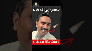 பல் விழுந்தால் என்ன செய்வது  What to do when a tooth is knocked out Dr Dinesh Kowsky [upl. by Bette]