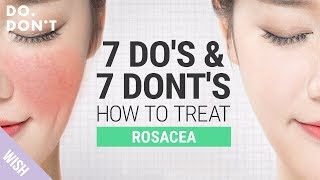 14 Tips for Rosacea That Really Work  Effective Skin Care Tips for Rosacea  Do amp Dont [upl. by Ahsinal]