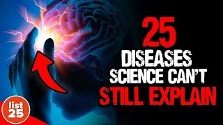 25 Mind Boggling Diseases That Science Cant Explain [upl. by Chiles275]