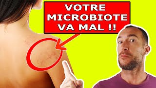 DYSBIOSE  3 Signes SURPRENANTS Que Votre Microbiote Va Mal [upl. by Kitrak]