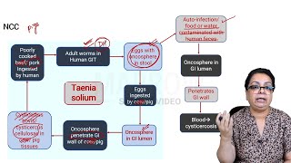 E6 Sample Video Toxoplasmosis and Neurocysticercosis Microbiology [upl. by Emoreg]