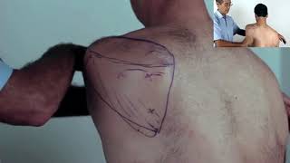 Trigger Point Master Class  How to Release Infraspinatus [upl. by Farrison]