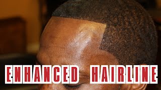 How to Apply Toppik Hair Fibers  Crispy Shape Up [upl. by Mireielle]