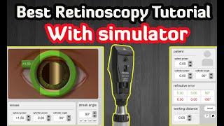 Retinoscopy Simulator  Practice Online  Tutorial [upl. by Eilzel]