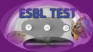 ESBL LABORATORY TESTS SWAHILI SBK [upl. by Annodam]