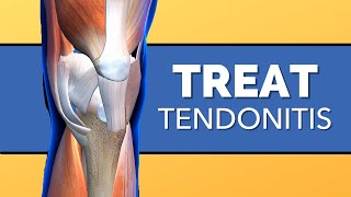 How to Treat Tendonitis of the Knee [upl. by Aicnarf]