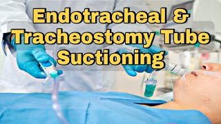 Suctioning National Tracheostomy Safety Project [upl. by Chesney]