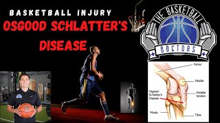 Basketball Injury Osgood Schlatters Disease [upl. by Anilys]