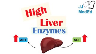 High Liver Enzymes  Aspartate vs Alanine Aminotransferase AST vs ALT  Causes [upl. by Ylagam]