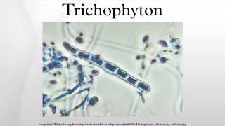 Trichophyton [upl. by Swarts]