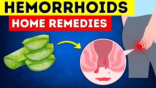 Say Goodbye to Hemorrhoids 8 Home Remedies That Actually Work [upl. by Einnahpets]