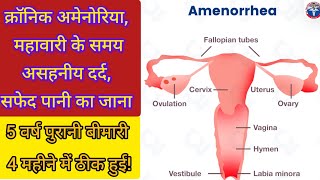 amenorrhoea painful menses white discharge success treatment [upl. by Karissa]