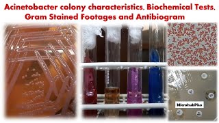 Acinetobacter colony characteristics Biochemical Tests Gram Stained Footages and Antibiogram [upl. by Zak]