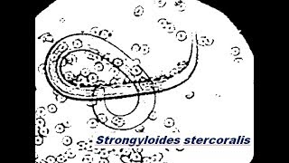 Strongyloides stercoralis [upl. by Adniral]