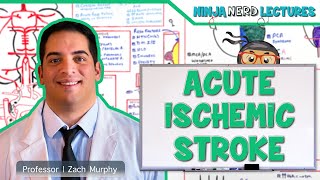 Acute Ischemic Stroke Etiology Pathophysiology Clinical Features Diagnostics Treatment [upl. by Llerdnod]