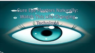 Cure Eye Floaters Naturally Watch This LifeChanging Technique [upl. by Dunc]