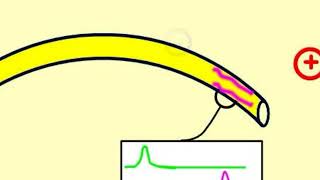 kwantitatieve electroforese [upl. by Marjy]