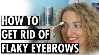 How to Get Rid of Flaky Eyebrows [upl. by Rosemarie613]