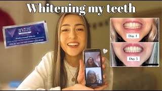 TESTING CREST 3D WHITESTRIPS  honest review [upl. by Akiemahs]