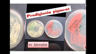 Prodigiosin pigment formation in Sarratia Serratia marcescens Prodigiosin [upl. by Truc]