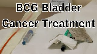 BCG Treatment for early Bladder Cancer chemo May 2016old version [upl. by Noteek]