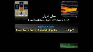 HowToPerform Carotid Doppler Step2 Differentiate ICA from ECA [upl. by Annahaj]