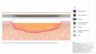 PROMOGRAN PRISMA™ Wound Balancing Matrix  Mode of action [upl. by Grethel]