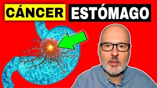 SÍNTOMAS PELIGROSOS DE CÁNCER ESTÓMAGO GÁSTRICO 💥 Causas Prevención y Tratamiento [upl. by Llemert588]