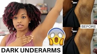 How To Lighten Dark Underarms Naturally and Fast  BEFORE AND AFTER RESULTS  journeytowaistlength [upl. by Naitsirc]