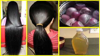 How To Grow Long and thicken Hair Naturally and Faster  Magical Hair Growth Treatment 100 Works [upl. by Vowel]