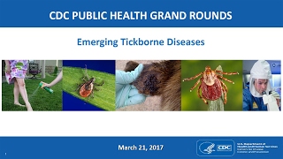 Emerging Tickborne Diseases [upl. by Eahsat124]