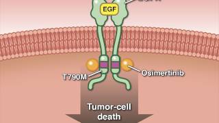 Osimertinib in Advanced Non–SmallCell Lung Cancer [upl. by Verner]