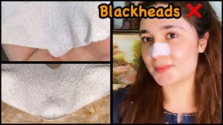 Best Way To Remove “ Blackheads “ [upl. by Pugh]