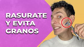 Evita Los Granitos y Aprende a rasurarte Adios Foliculitis e Irritación [upl. by Leonhard742]