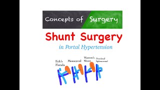 Shunt Surgeries in Portal Hypertension [upl. by Eilrebmik312]