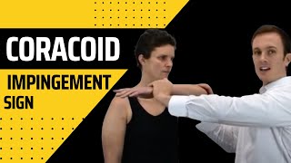 Coracoid Impingement Sign  Modified HawkinsKennedy Shoulder Impingement Test [upl. by Hemminger]