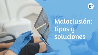 ¿Qué son las maloclusiones dentales  Dr Fernando Loscos Morato  Especialista en Estomatología [upl. by Nahsad]