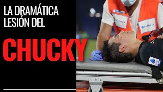 CHUCKY LOZANO lesionado SUFRE fuerte GOLPE en el PÓMULO [upl. by Aerdnna]