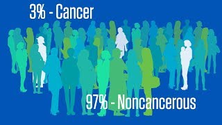 Understanding CA125 Screening for Ovarian Cancer [upl. by Zat]