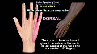 Ulnar Sided Wrist Pain  Differential Diagnosis [upl. by Randell]