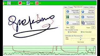 Grafopatologías Parkinson Software Forense Grafología Adriana Ziliotto Psicólogo ciencias forenses [upl. by Etnohc]