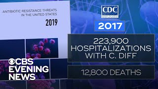 CDC report warns of 2 new potentially deadly superbugs [upl. by Yelah]