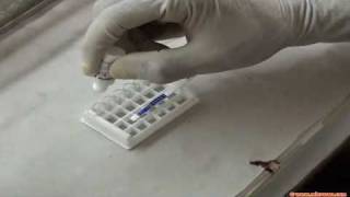 Rapid malaria test [upl. by Enoved719]