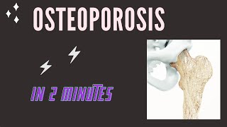 Osteoporosis in 2 mins [upl. by Aitital]