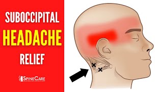 How to Release Tight Suboccipital Muscles  HEADACHE RELIEF in Seconds [upl. by Truitt901]